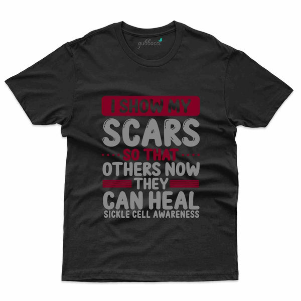 My Scars T-Shirt- Sickle Cell Disease Collection - Gubbacci