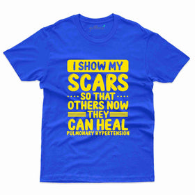 Scars T-Shirt - Hypertension Collection